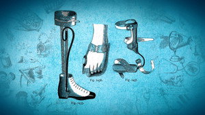 Orthopedics