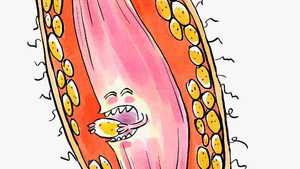 Want to Slim Down? Fat Chance